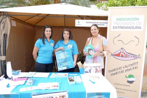 Afisuextrem celebra unas jornadas sobre la fisura labio-palatina el 15 de octubre